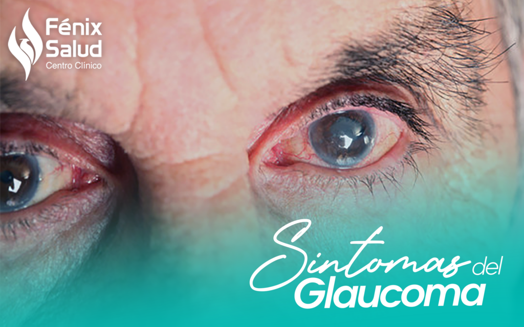 Cómo identificar los síntomas del glaucoma Centro Clínico Fenix Salud