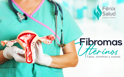 Fibromas uterinos: Tumores no cancerosos