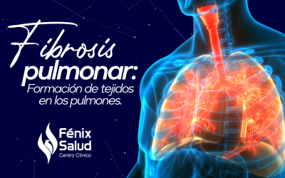 Fibrosis pulmonar: formación de tejido en los pulmones