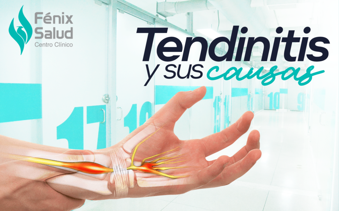 Tendinitis, causas de la tendibnitis, síntomas de la tendinitis, ¿cuáles son las causas de la tendinitis?, ¿cuáles son los síntomas de la tendinitis?, tendinitis centro clínico fénix salud
