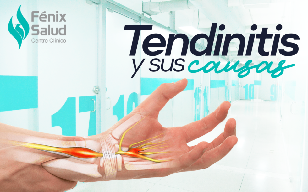 Tendinitis Y Sus Causas - Centro Clínico Fenix Salud