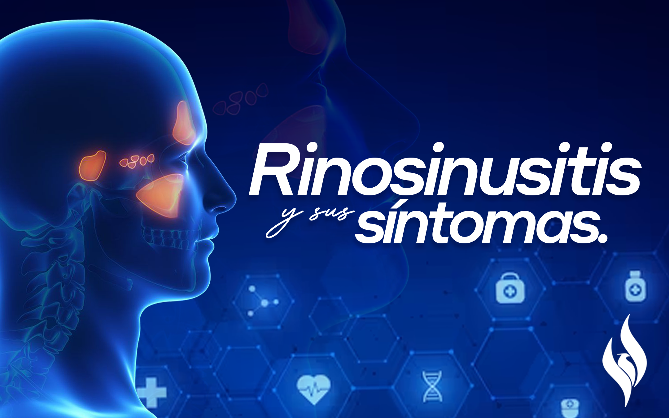 Rinosinusitis Y Sus Síntomas Centro Clínico Fenix Salud 2295