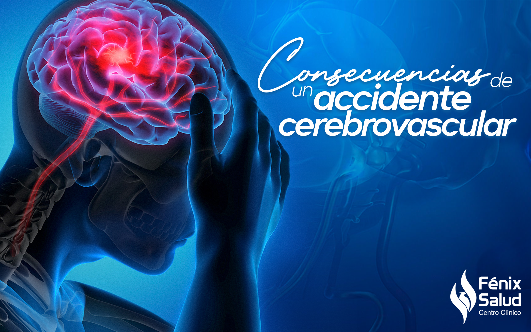 persona de accidente cerebrovascular