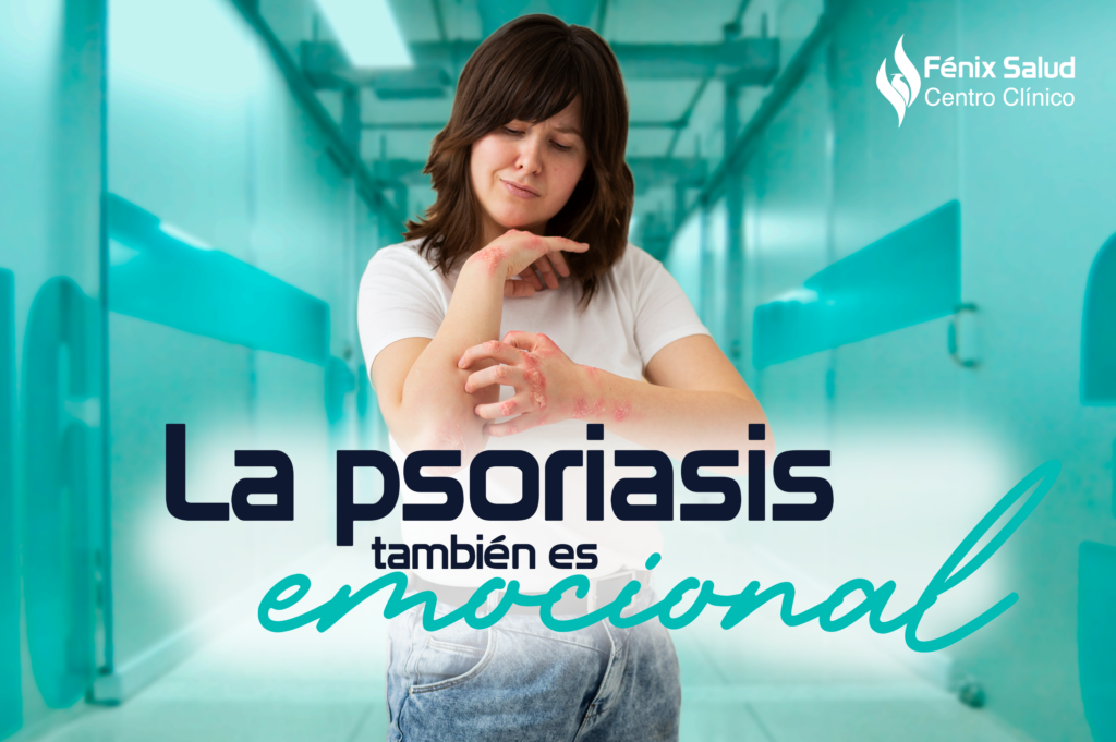 La Psoriasis También Es Emocional Centro Clínico Fenix Salud 8232