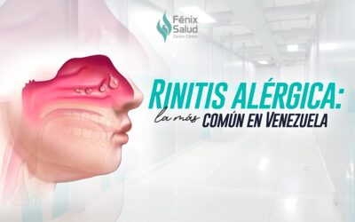 Rinitis alérgica: La más común en Venezuela